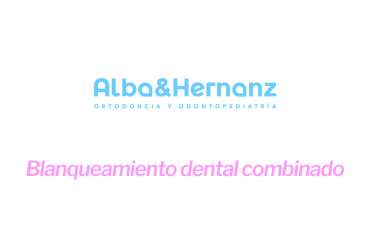 Blanqueamiento Dental Combinado