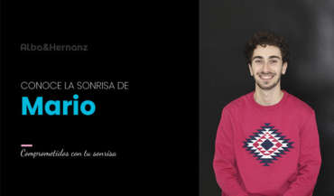 Mario , 25 años, Brackets estéticos 3m Clarity Ultra