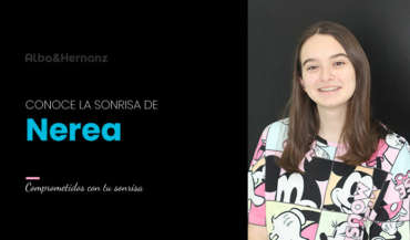 Nerea, 18 años, Brackets de autoligado Damon + Microtornillo